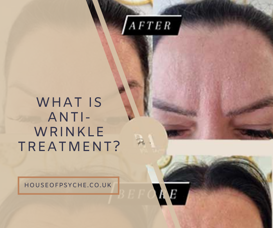 What is anti-wrinkle treatment?